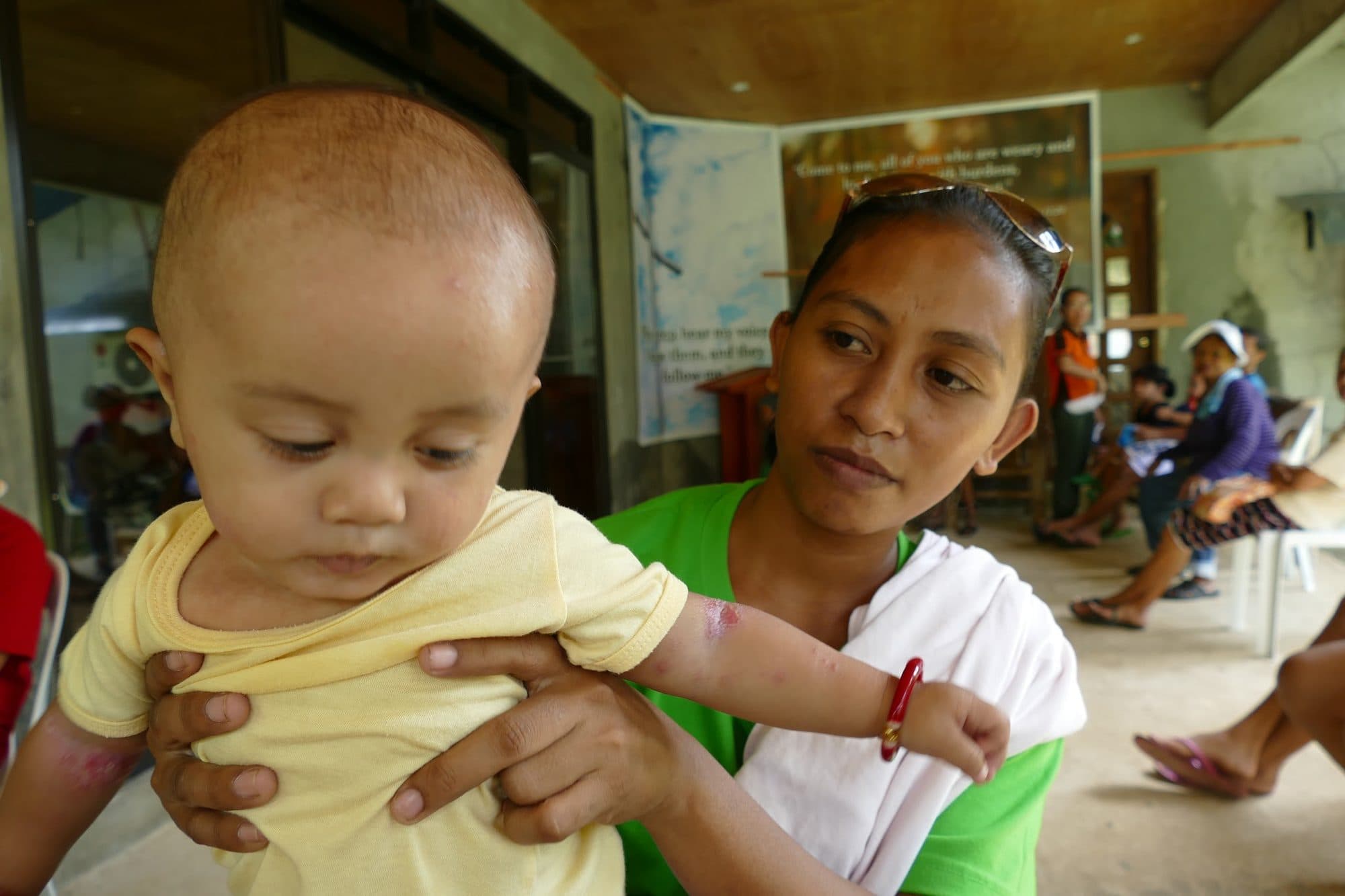 A mother holds her baby at the clinic